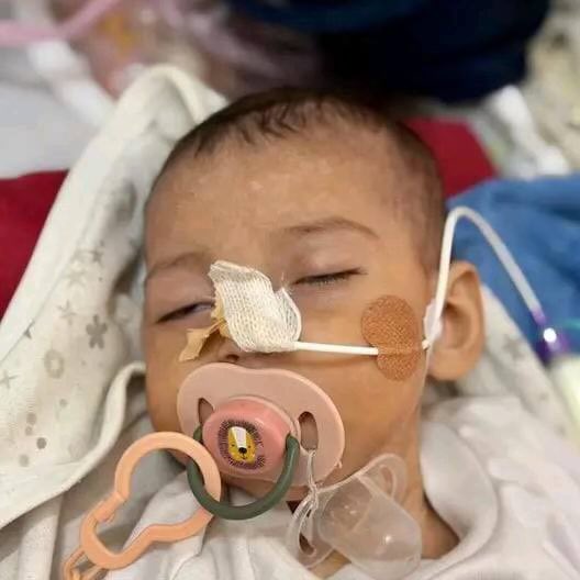 5-Month-Old Girl Dies From Lack of Medical Care During Siege