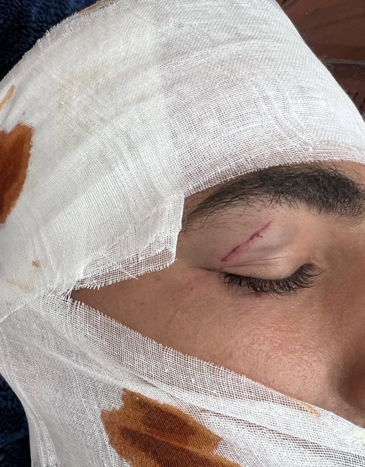Son wounded in Israeli bombing at UNRWA headquarters in Gaza