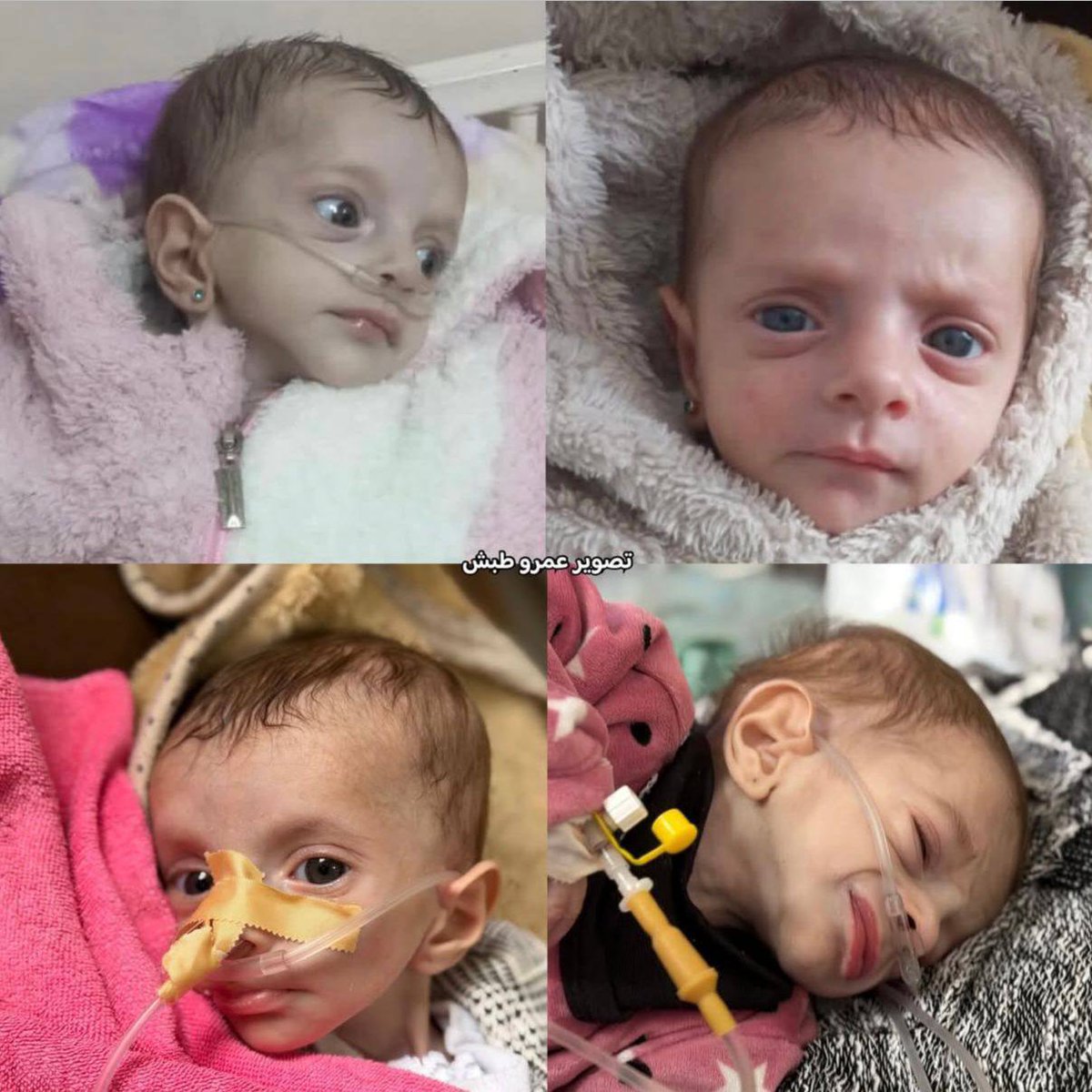 Infant Girl Alma Abu Reda Dies Awaiting Medical Treatment Abroad