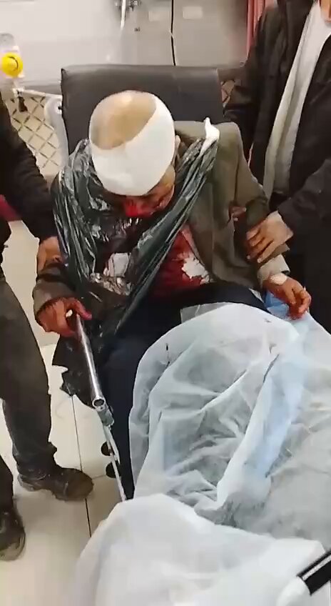 Israeli Settlers Attack Tayasir Village Residents, Multiple Injured