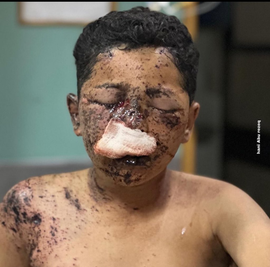 Gaza: Four killed, seven wounded by Israeli forces in 24 hours