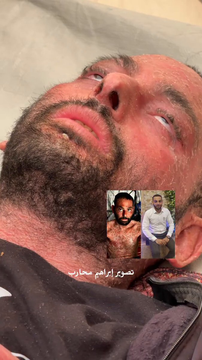 Urgent medical evacuation plea for critically ill Ibrahim Abu Aram from Gaza