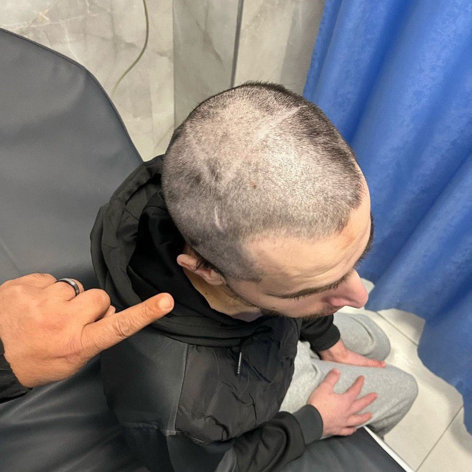 Freed Palestinian prisoner bears carved Star of David after release
