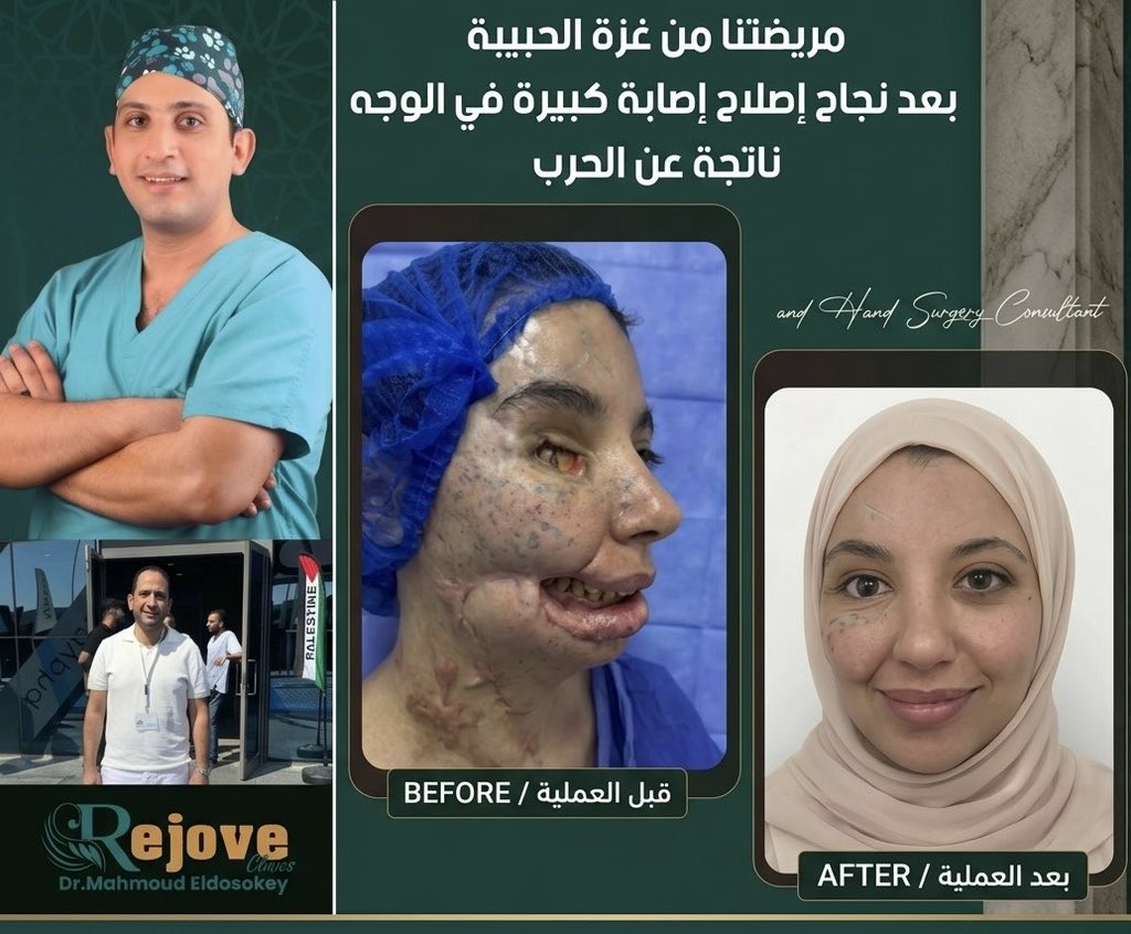 Egyptian Doctor Treats Palestinian Woman Injured in Gaza Attack