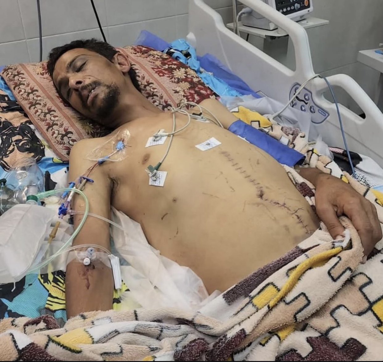 Palestinian Ex-Prisoner Rami Abu Mustafa Dies After Release