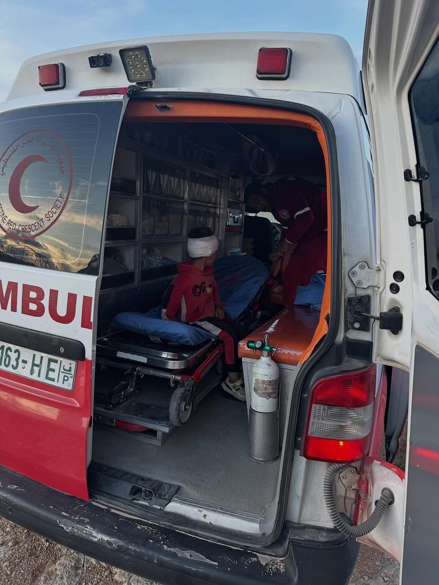 Child injured in settler attacks on Tuba village, Masafer Yatta