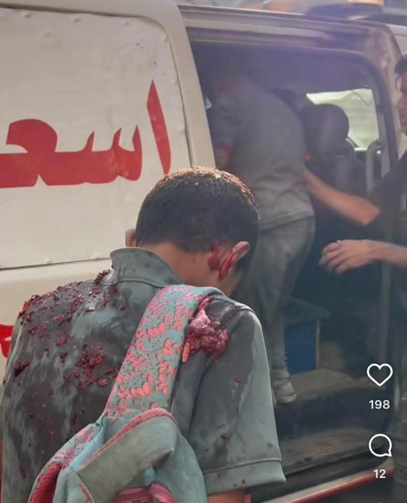 Ongoing attacks in northern Gaza cause casualties and suffering