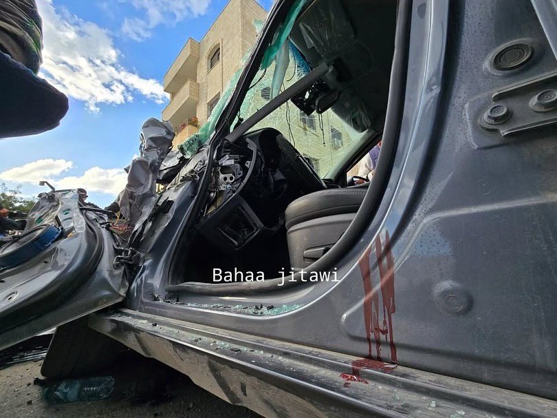 Palestinian dies from injuries after Israeli vehicle ramming in Tulkarm