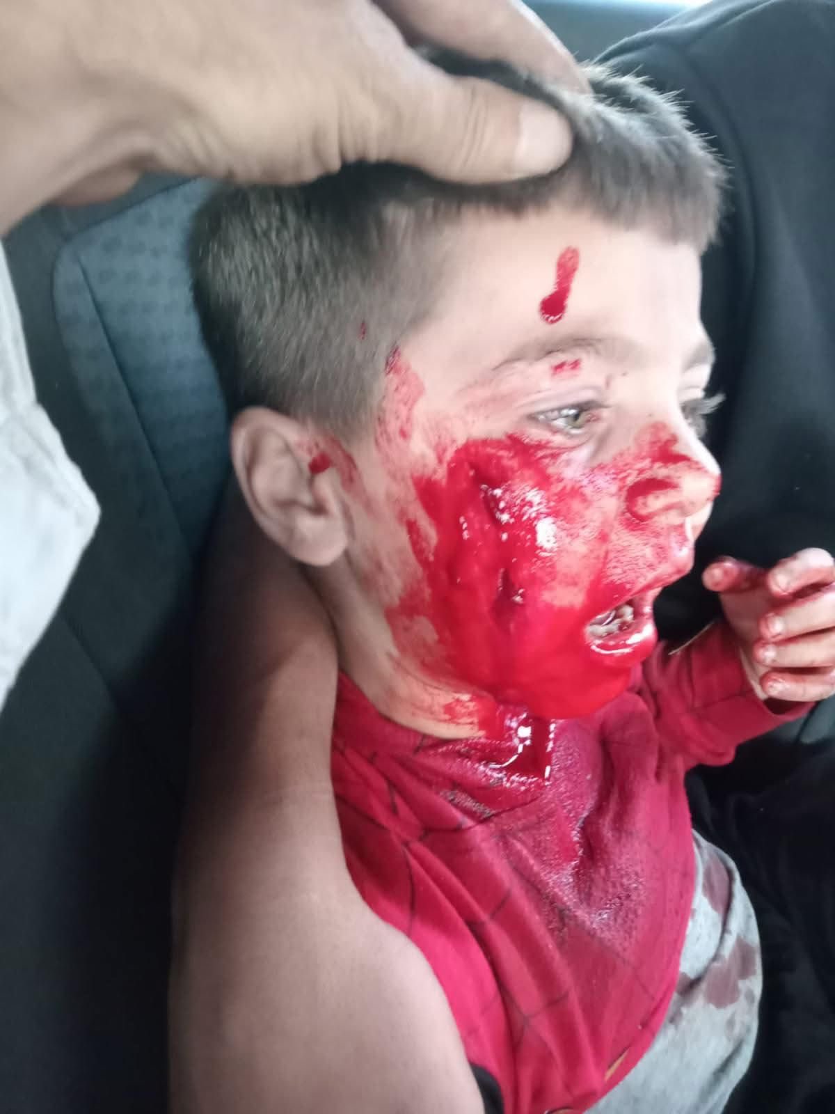 Child injured after settler assault in West Bank Hebron
