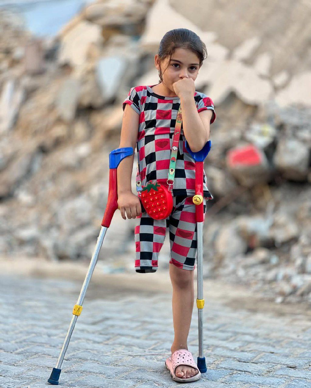 Injured Child Miral Shukri Al-Babli Lost Family and Leg