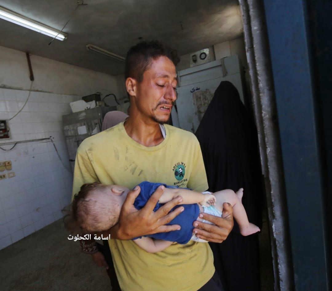 Child Amir Al-Adwi dies in Gaza due to lack of medical treatment