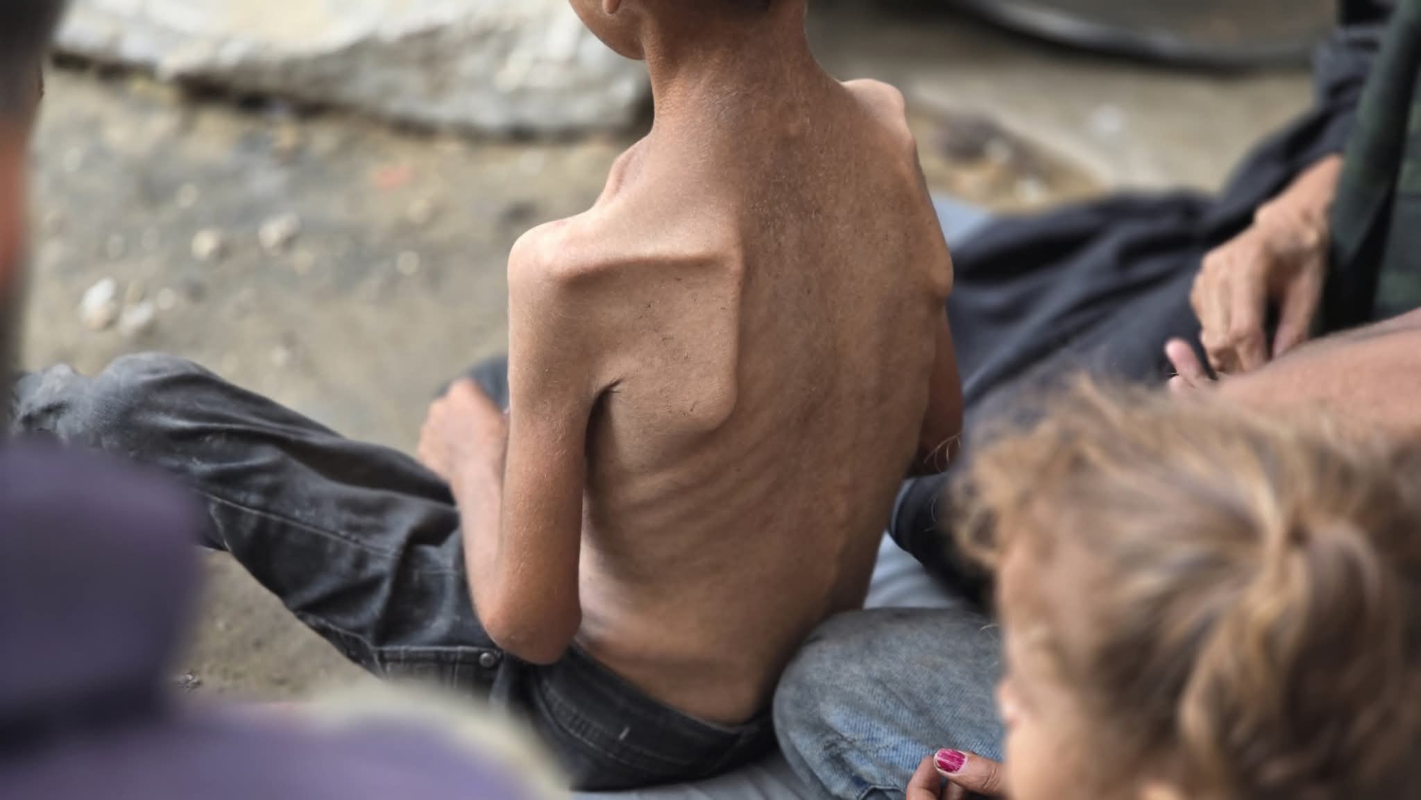 Gaza families struggle with hunger and food scarcity in displacement camps