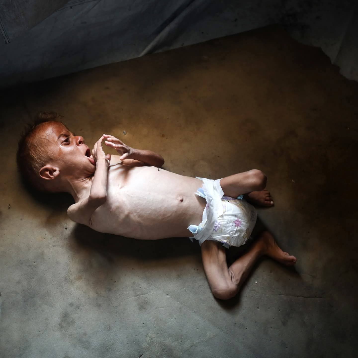 Gaza under threat: children dying from hunger, urgent call for awareness