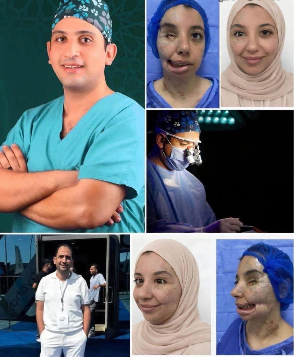 Egyptian Doctor Restores Hope to Palestinian Girl from Gaza
