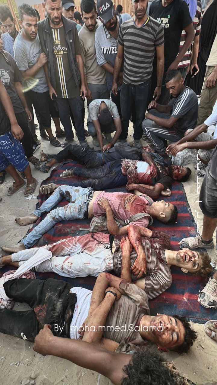 Nasser Hospital Reports 25 Deaths and 70 Wounded in Gaza