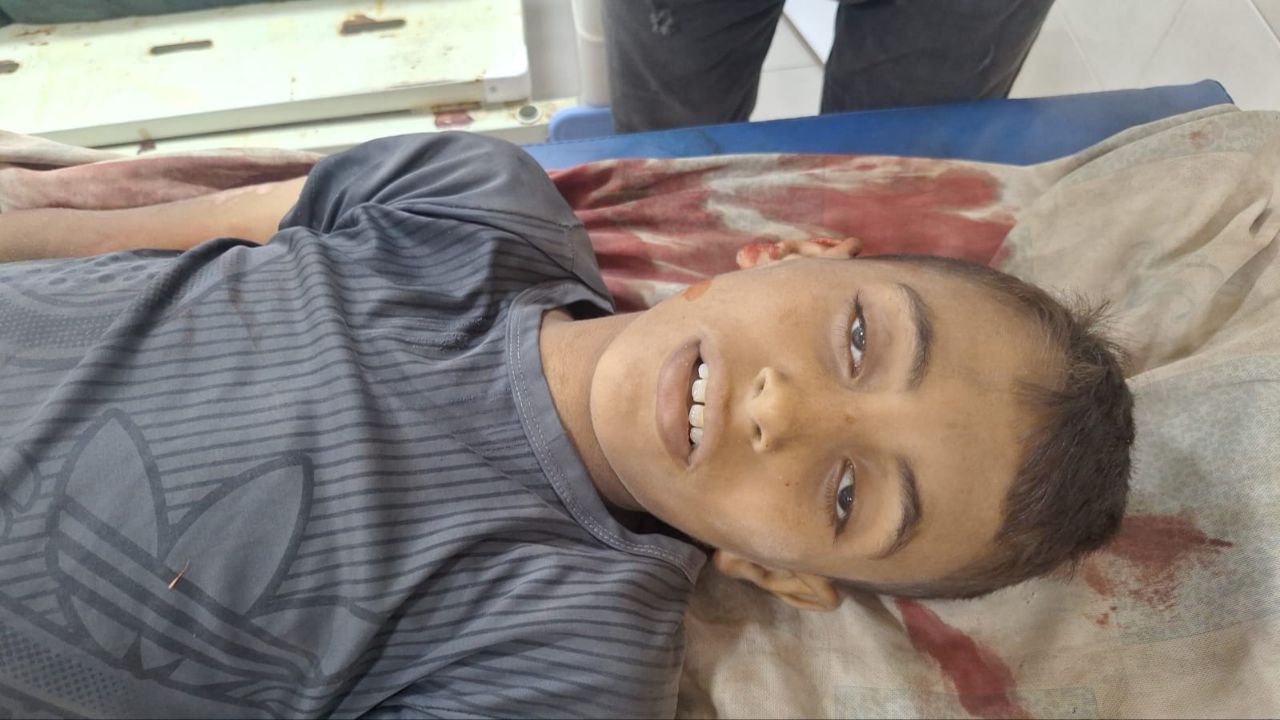 Children dying from hunger and sniper bullets in Gaza conflict