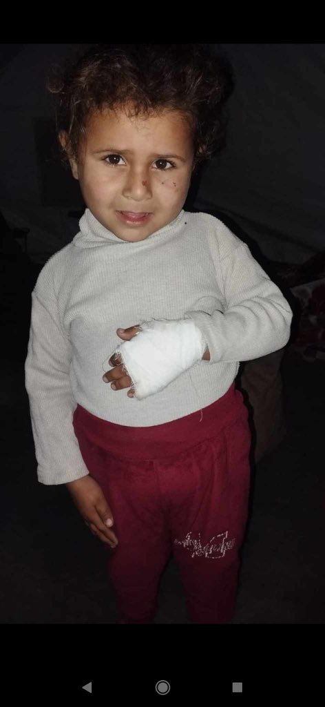 Girl bitten by rat while sleeping in Gaza tent