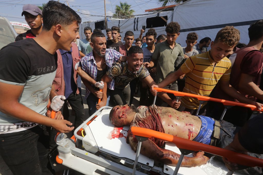 One killed, several injured including child in Gaza City
