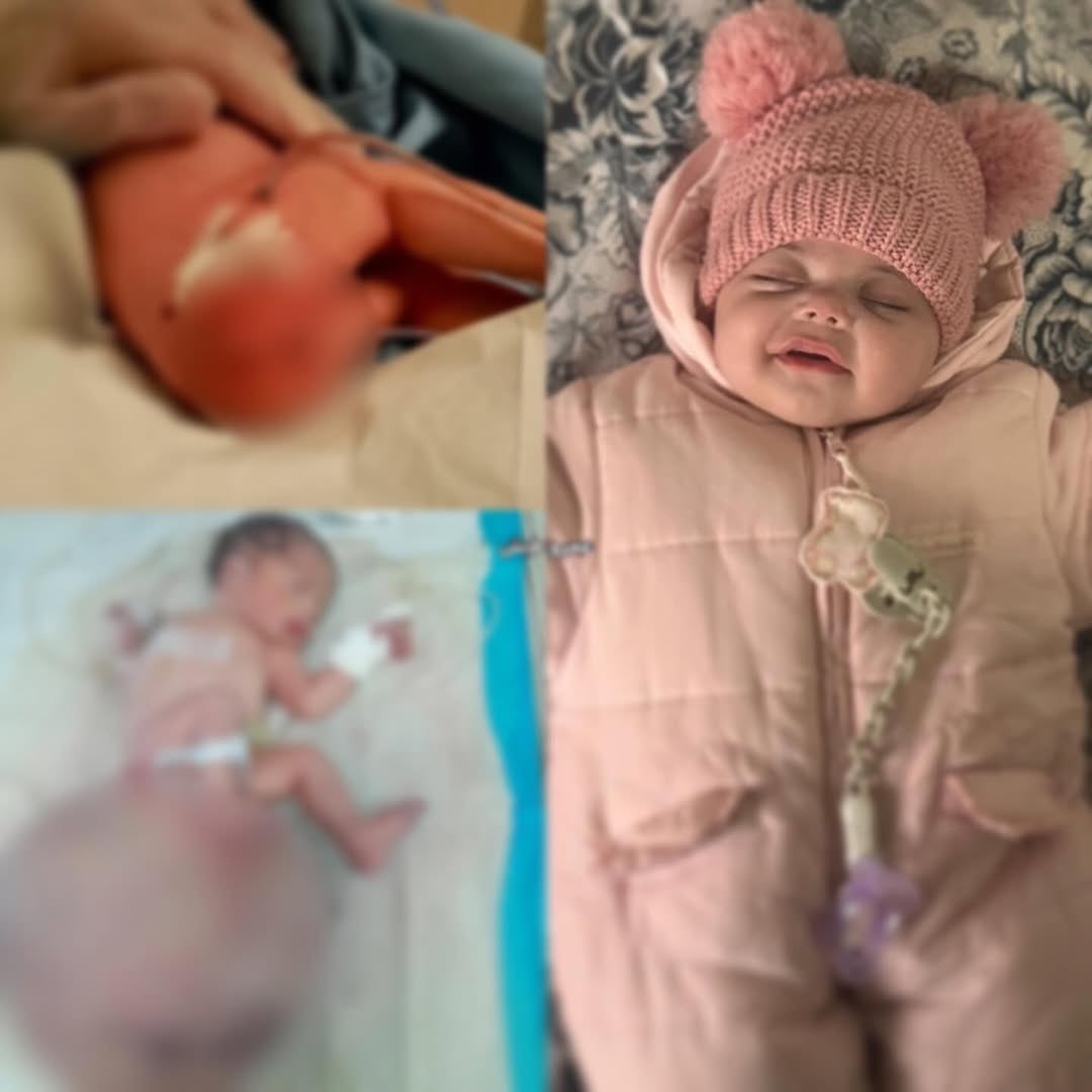 Successful Removal of Rare Tumor in Gazan Child