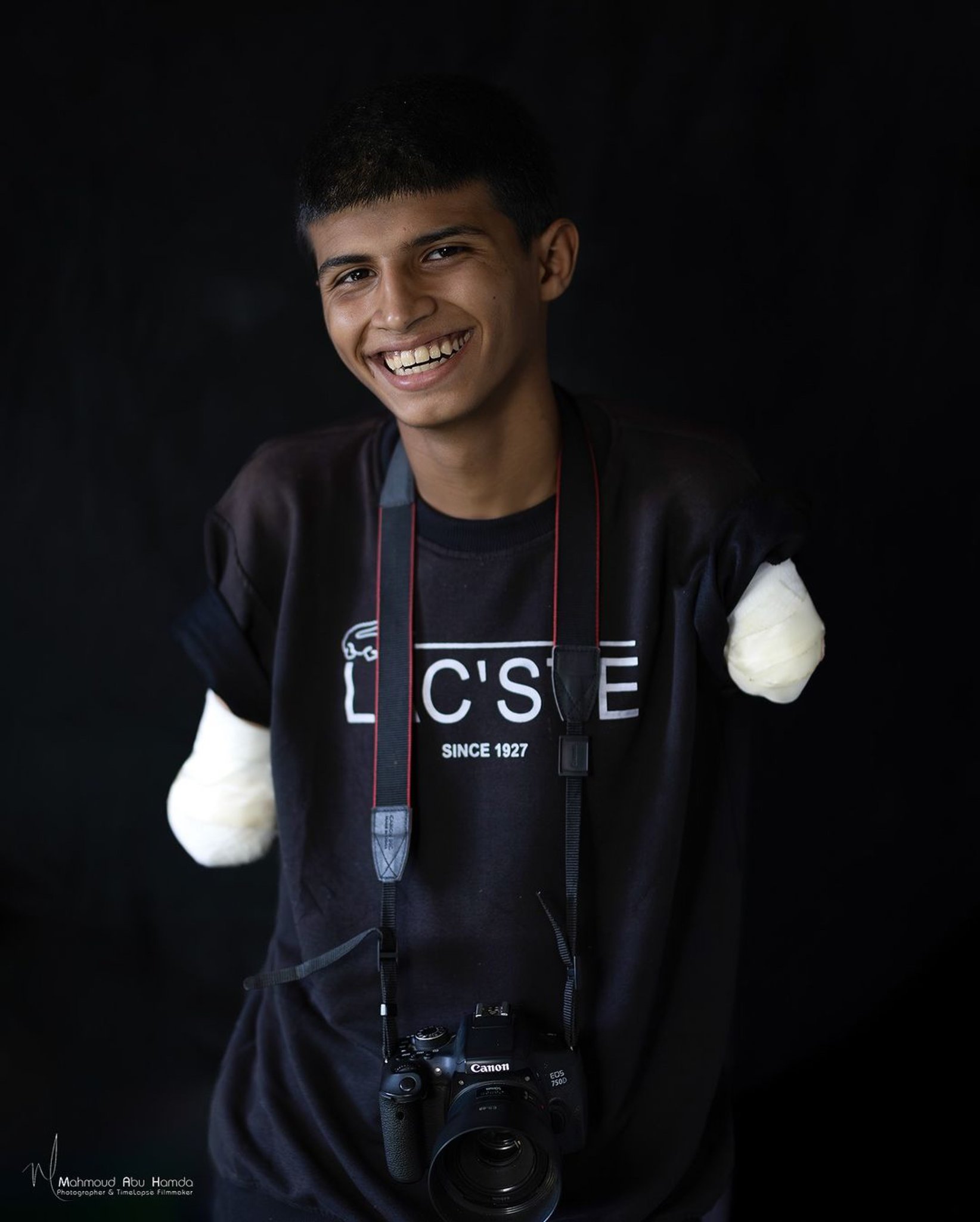 Young Boy Lost Both Hands in Missile Strike Remains Determined