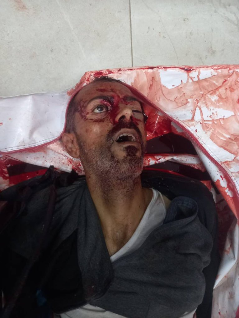 Gaza casualty statistics from Israeli military operations May-June 2025