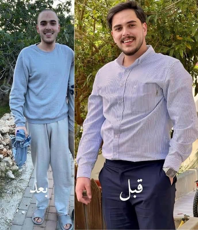 Palestinian Prisoner Released After Severe Weight Loss and Illness