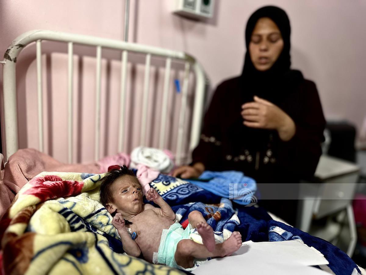 Infant death from malnutrition and formula shortage reported