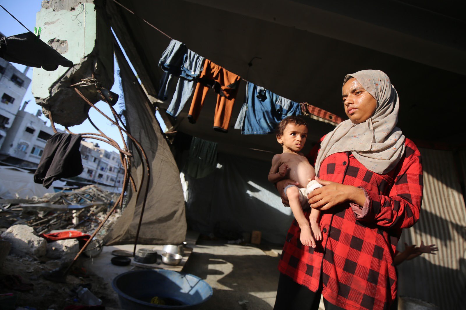 Survivor’s Acute Malnutrition from Food Restrictions
