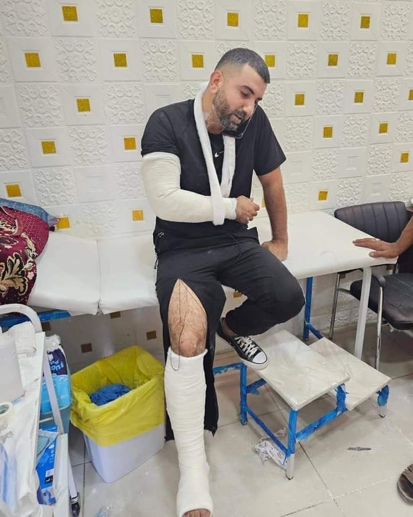 Palestinians injured in settler attack near Ramallah