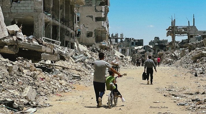 Child Lost Legs to Gaza Bombing, Sits on Bicycle