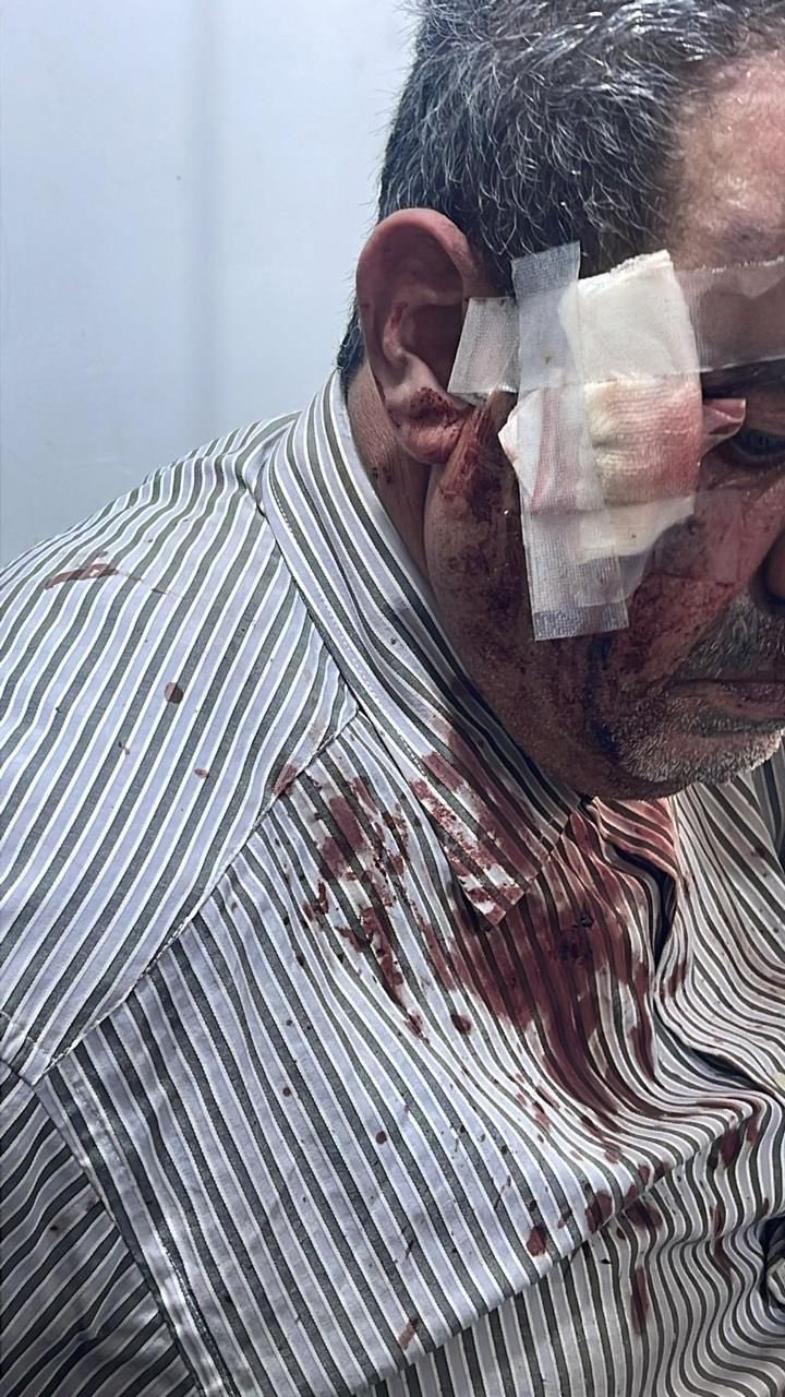 Israeli settlers attack Palestinian families during olive harvest