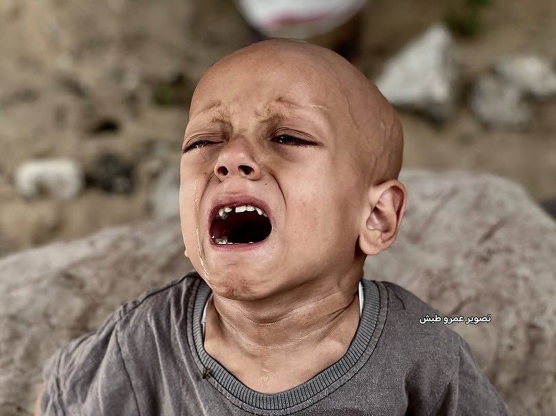 Children suffering in conflict: hunger, sickness, and silent struggle