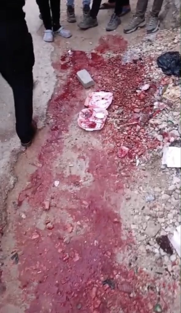 Israeli forces wound Palestinian youth in West Bank Jenin