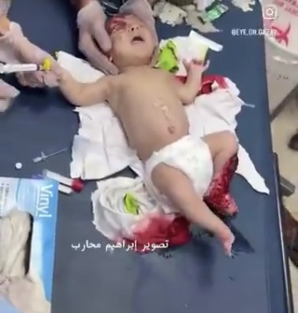 Baby targeted as terrorist by Israeli forces in Khan Younis tent