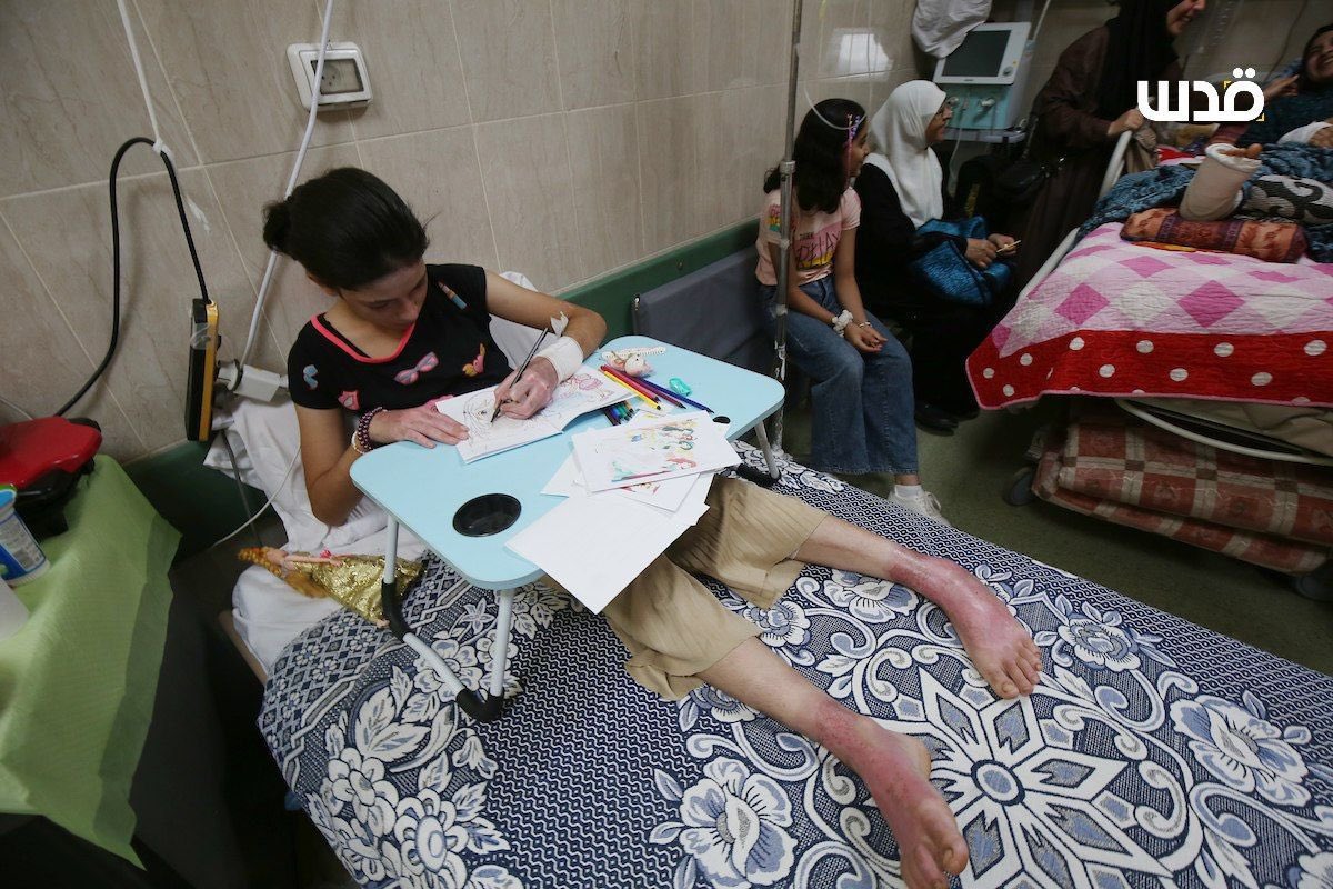 Palestinian Family Injured in Israeli Airstrike on Home