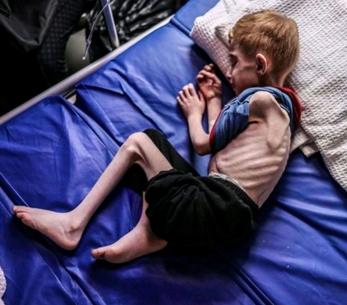 Gaza Starvation: Genocide or Political Crisis?