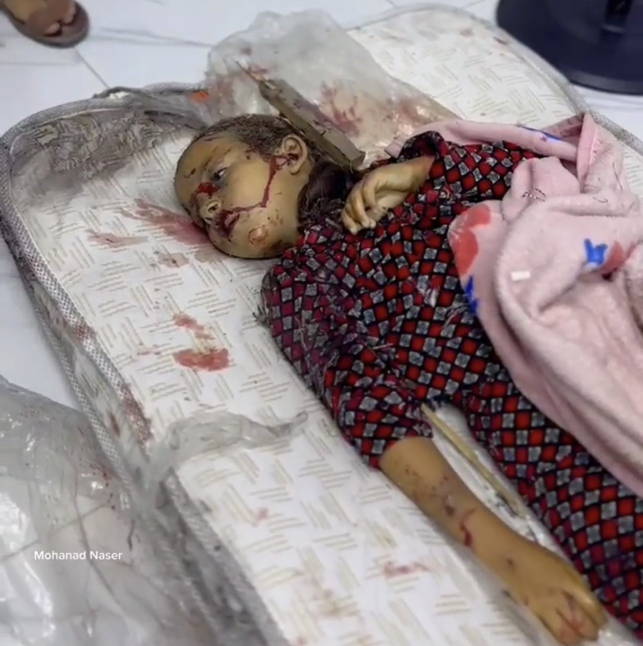 Casualties reported in Israeli airstrikes on Gaza locations