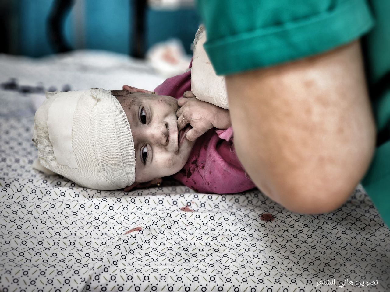 Palestinian children injured in Israeli airstrike on Khan Younis