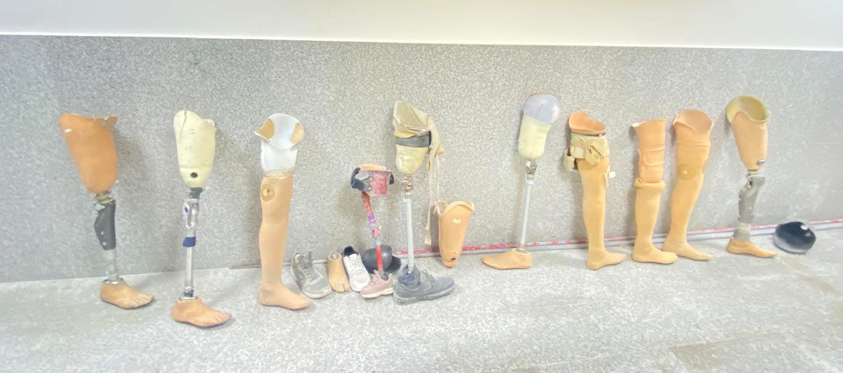 Prosthetics Workshop Visit in Gaza May 2025