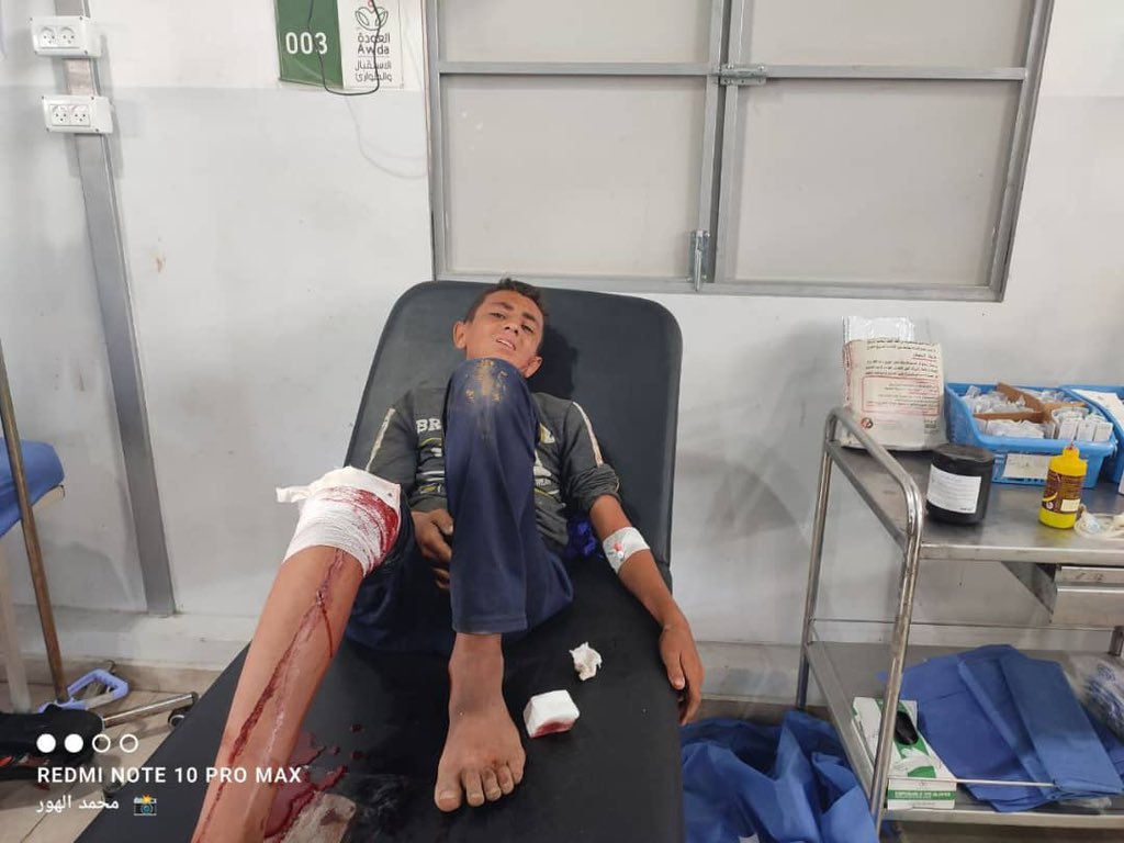 Israeli bombing kills one, wounds several in Al Nuseirat refugee camp