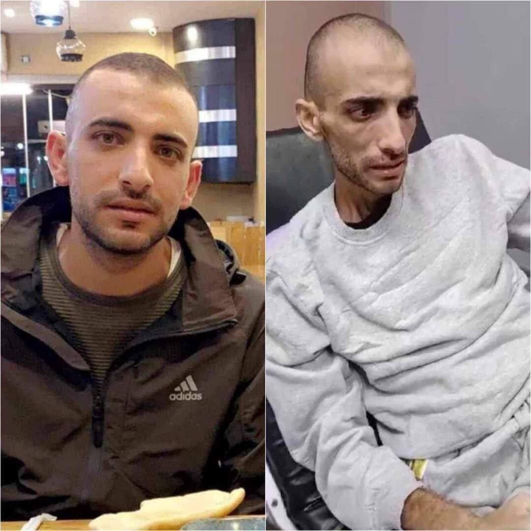 Palestinian Prisoner Dies After Cancer Treatment Neglect