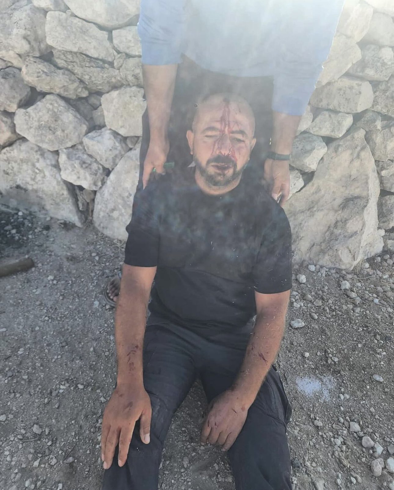 Israeli settlers attack Palestinian in Masafer Yatta, Hebron