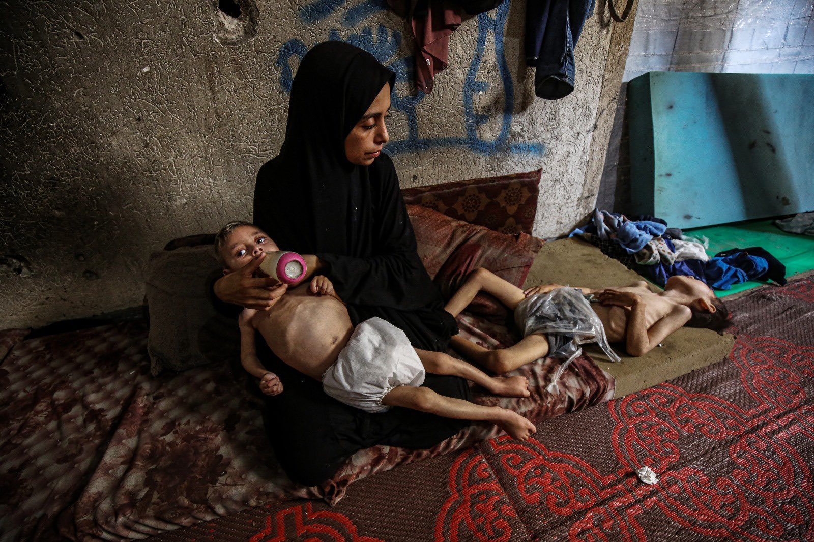 Healthcare Crisis for Children in Gaza Displacement Camp