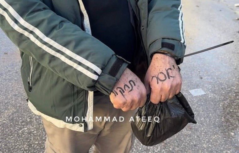 Palestinian from Qabatiya released after alleged abuse by occupation forces