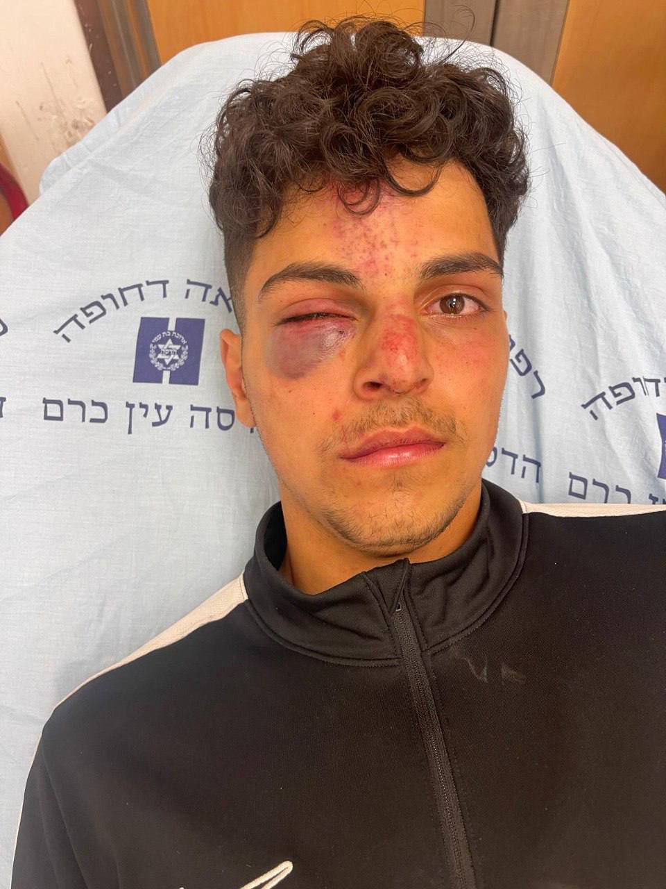 IOF soldiers assault jogger in Jerusalem Old City after settler chase
