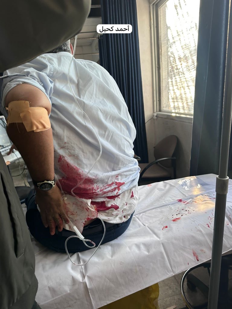 Israeli bombing kills one, injures 14 in Gaza City apartment