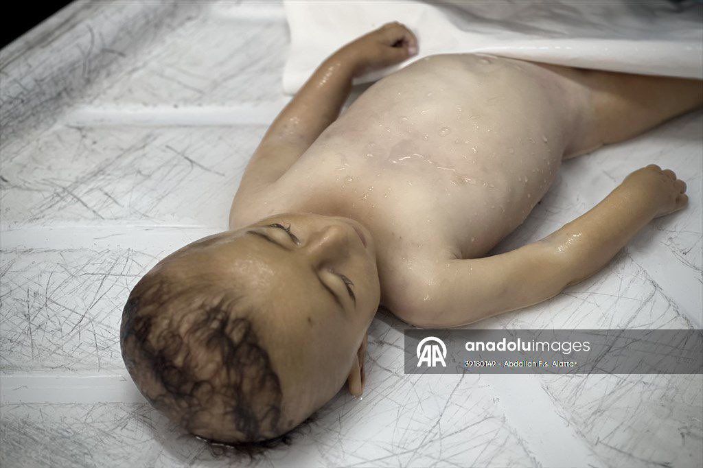 13 Children Dead at Gaza Hospital in 24 Hours
