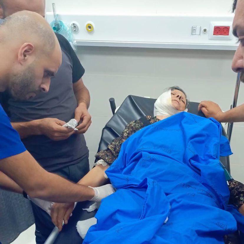 Israeli settlers injure woman and man in Masafer Yatta attack