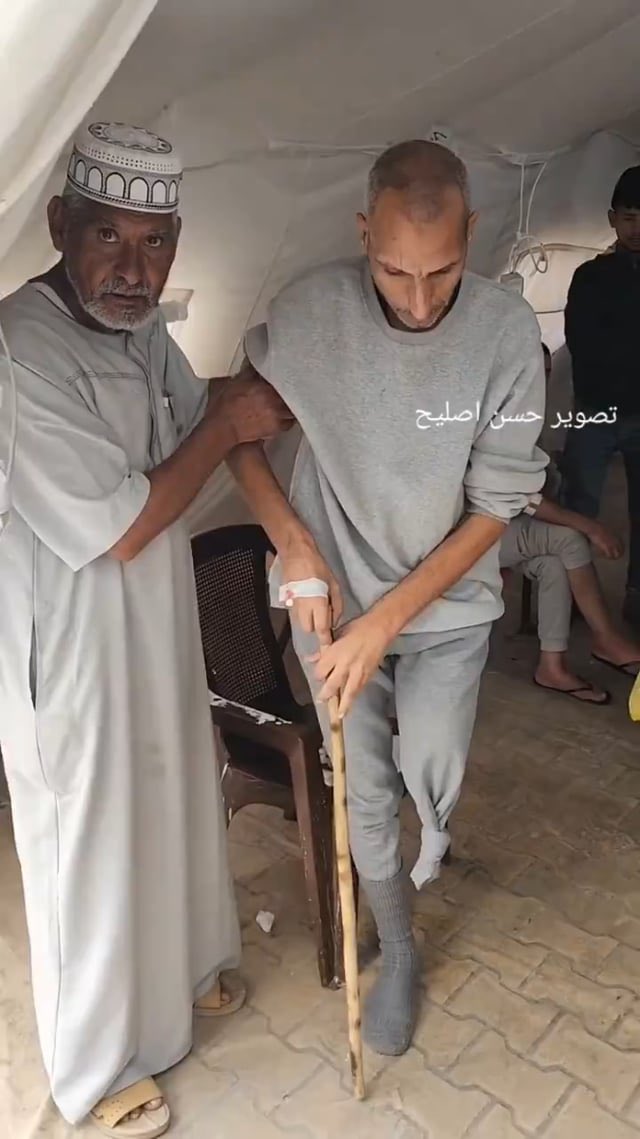 Palestinian man claims amputation after Israeli military detention