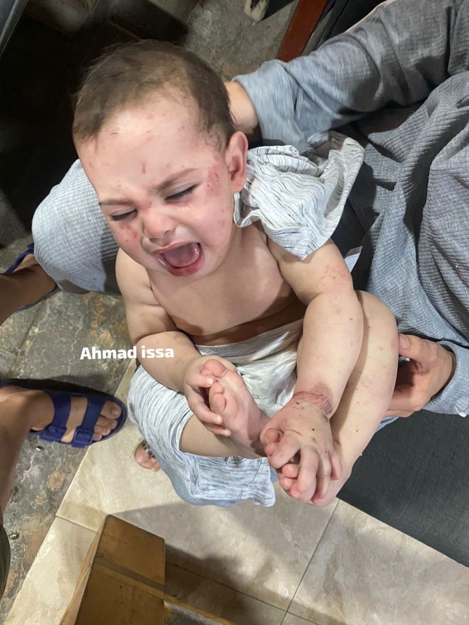 Bombing campaign targets babies and children in conflict